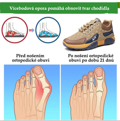 ventorte® | Novinka na trhu – Poloviční cena po omezenou dobu. Ergonomický design, vynikající odpružení a korekce chůze.