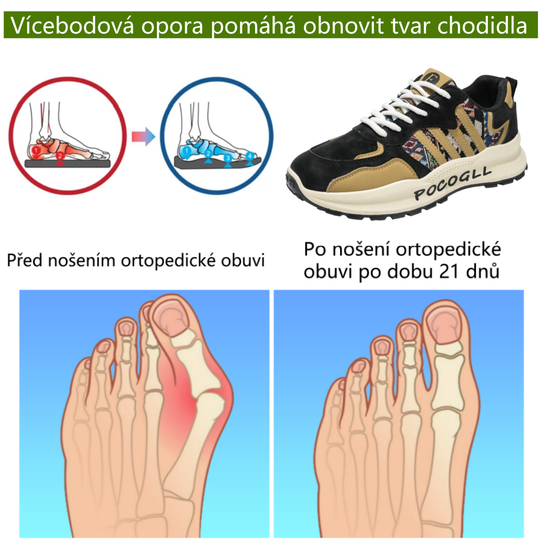 Tenisky deconr® | Široká špička snižuje tlak na chodidlo a poskytuje celodenní pohodlí.