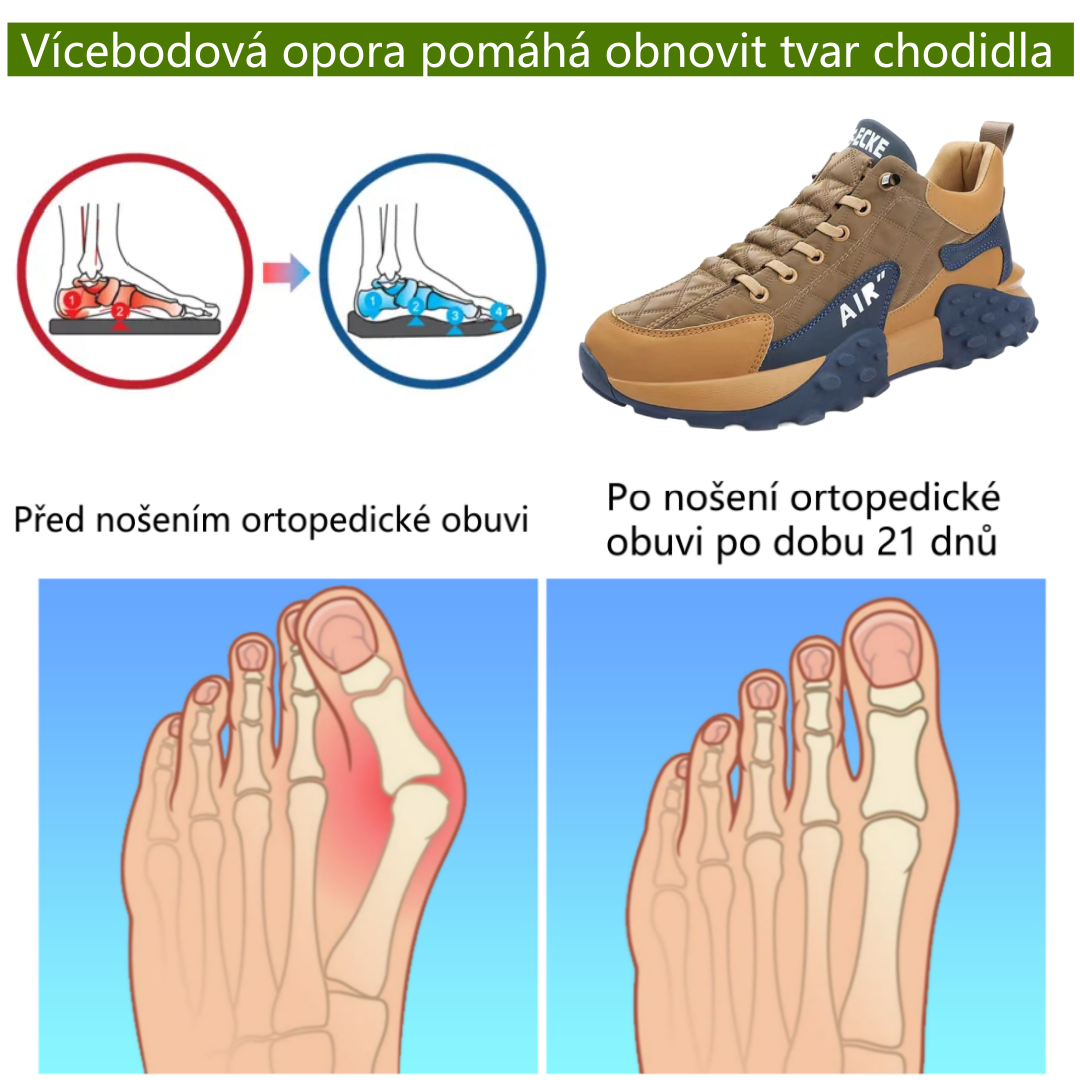 Ortopedická obuv ventorte® | Ergonomicky tvarovaná, měkká a pohodlná, zmírňuje únavu nohou po dlouhém dni.