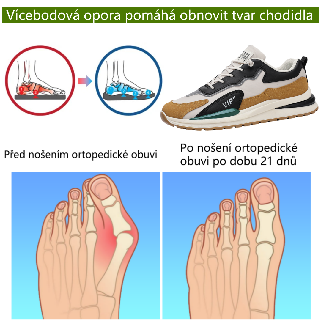 Zbrusu nová ergonomická ortopedická obuv - ✅ Přirozeně koriguje chůzi a zmírňuje bolest - Zvýšená voděodolnost a protiskluzovost 👞 Vyrobeno z vybrané australské kůže
