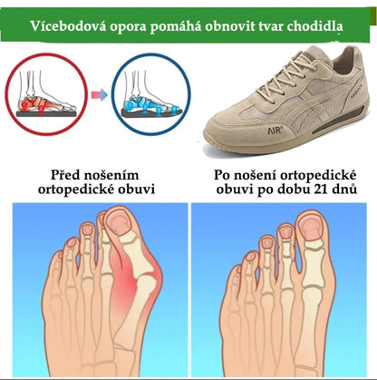 🔥 50% sleva | ortopedická obuv ventorte® | Poskytuje oporu klenby, zmírňuje bolest a usnadňuje chůzi | Vhodná pro muže i ženy.