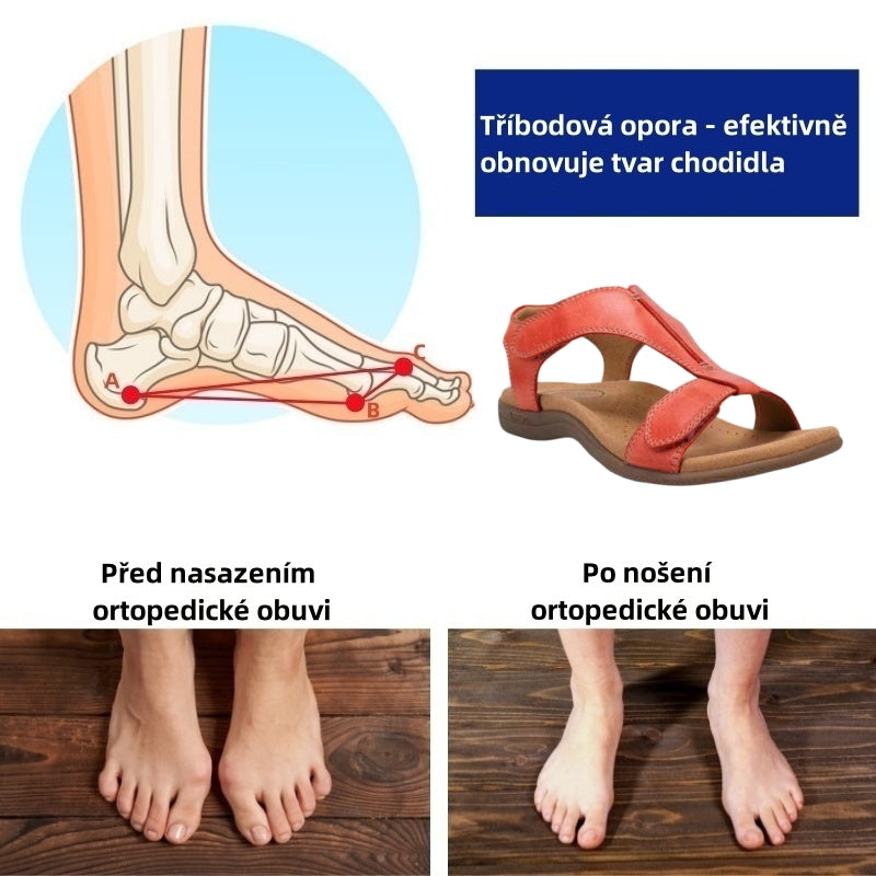 ⏰ Dnešní speciální nabídka: 50% sleva | Letní ortopedické sandály ventorte® | Podpora klenby, pohodlná a bezbolestná chůze
