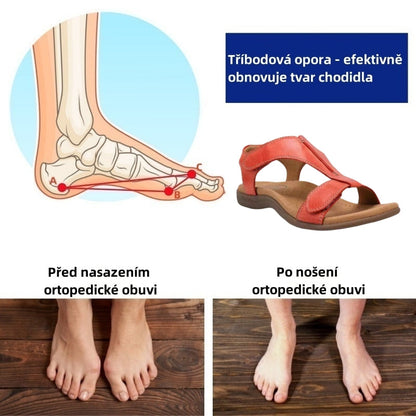 ⏰ Dnešní speciální nabídka: 50% sleva | Letní ortopedické sandály ventorte® | Podpora klenby, pohodlná a bezbolestná chůze