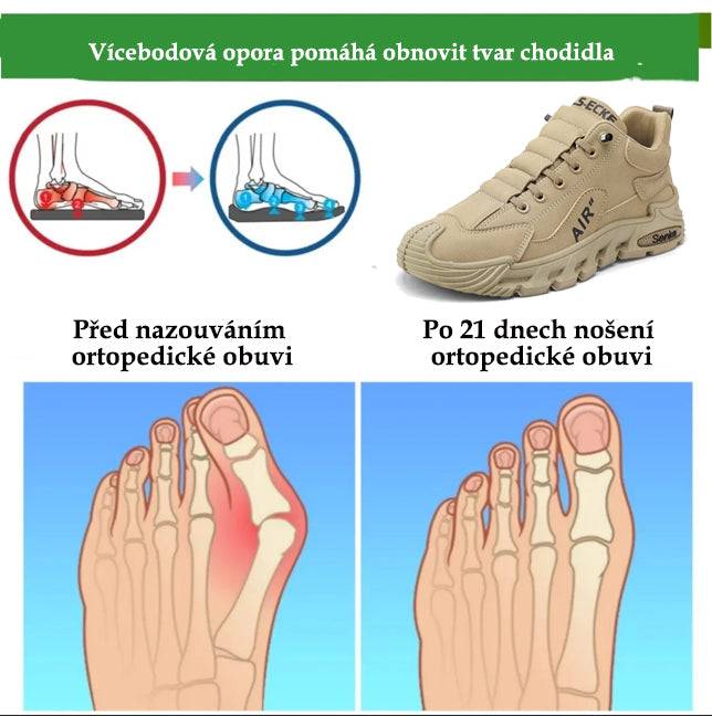 🔥 50% sleva | ortopedická obuv ventorte® | Poskytuje oporu klenby, zmírňuje bolest a usnadňuje chůzi | Vhodná pro muže i ženy.