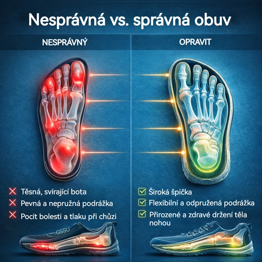 🔥 50% sleva | ortopedická obuv ventorte® | Poskytuje oporu klenby, zmírňuje bolest a usnadňuje chůzi | Vhodná pro muže i ženy.