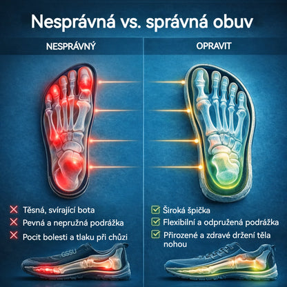 🔥 50% sleva | ortopedická obuv ventorte® | Poskytuje oporu klenby, zmírňuje bolest a usnadňuje chůzi | Vhodná pro muže i ženy.