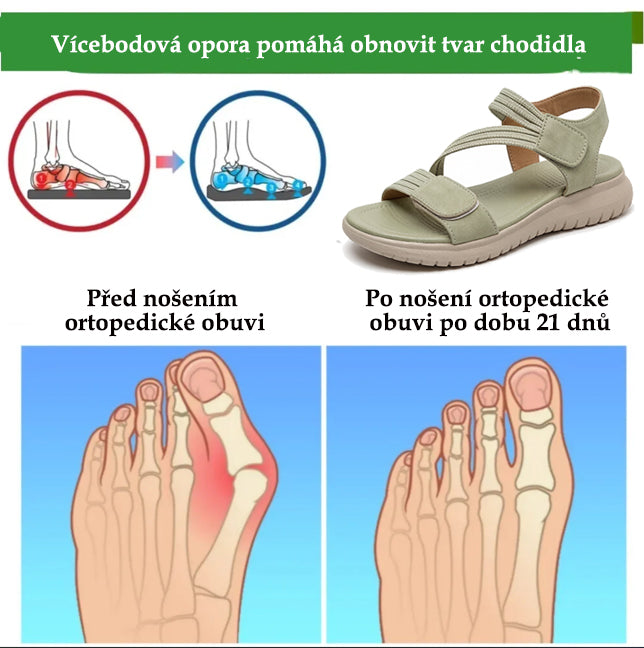 Pohodlné ortopedické sandály – ergonomická podpora klenby, nastavitelná šířka, zkrášlují nohy.