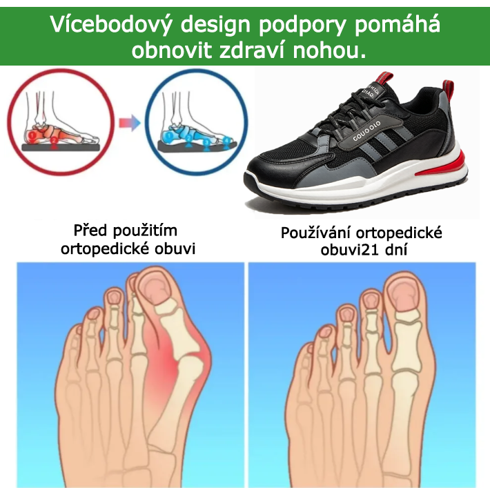 ventorte® 【🔥Dnešní speciální nabídka: sleva 50 %🎁】Pohodlná vycházková obuv | Lehká a odolná👟 | Žádná únava z celodenní chůze | Podpora klenby | Účinně zmírňuje problémy s chodidly✅