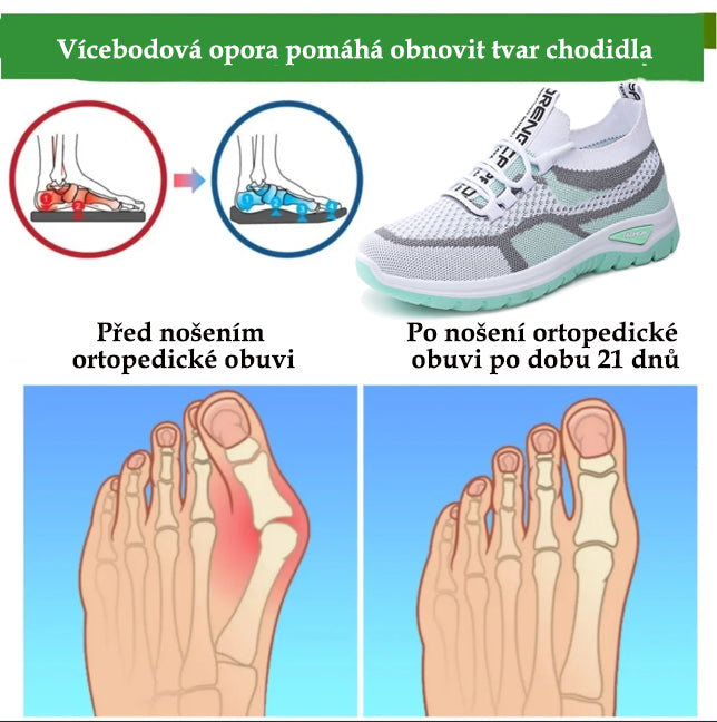 Ortopedická obuv ventorte® | Jarní obuv, která ulevuje od bolesti zad, kloubů a nohou; prodyšná a pohodlná