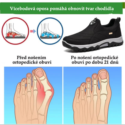 Pohodlná ortopedická obuv z semiše – měkká a pohodlná, s vynikající oporou – zmírňuje bolesti nohou.