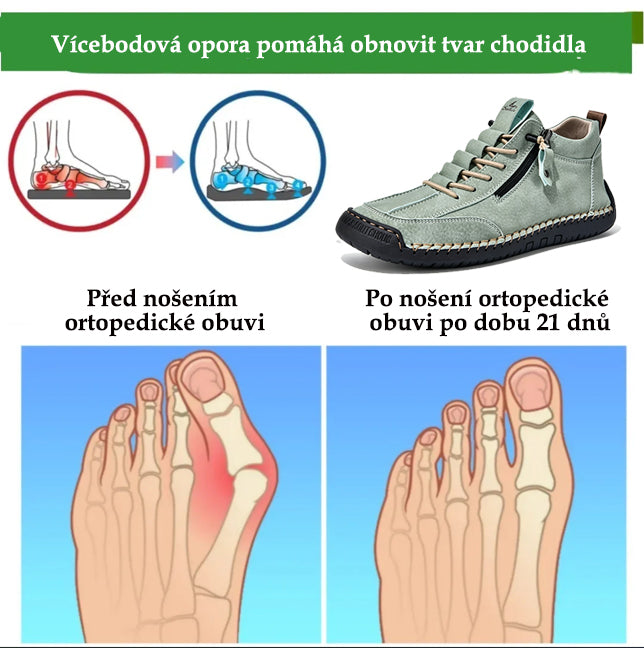 🔥 50% sleva | Ortopedická obuv ventorte® | Poskytuje oporu klenby, zmírňuje bolest a usnadňuje chůzi | Vhodná pro muže i ženy.