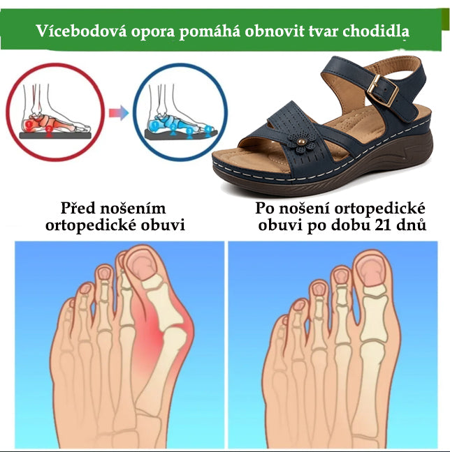 Ergonomické ortopedické sandály – s podporou klenby, která pomáhá zmírnit bolest nohou, stabilizovat patu a snížit nestabilitu při chůzi