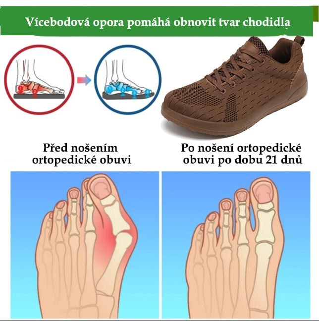 🔥 50% sleva | Prodyšná ortopedická obuv Ventorte® | Poskytuje oporu klenby, zmírňuje bolest a usnadňuje chůzi | Unisex