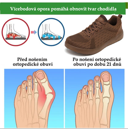 🔥 50% sleva | Prodyšná ortopedická obuv Ventorte® | Poskytuje oporu klenby, zmírňuje bolest a usnadňuje chůzi | Unisex