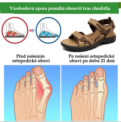 🎉Poslední den! Sleva 50 %! ✅ Ortopedické zdravotní sandály určené speciálně pro lidi s problémy s nohama k úlevě od bolesti zad, kloubů a chodidel.