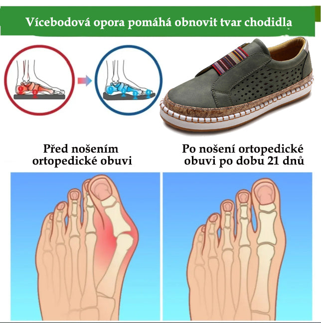 Pohodlná ortopedická obuv – s podporou klenby, zmírňuje bolest; prodyšná.