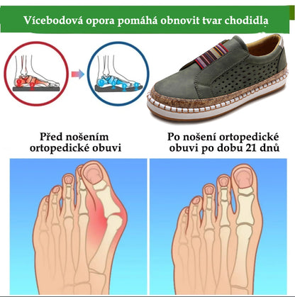 Pohodlná ortopedická obuv – s podporou klenby, zmírňuje bolest; prodyšná.