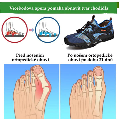 🔥 50% sleva | Ortopedické sandály Ventorte® | Poskytují oporu klenby, zmírňují bolest a usnadňují chůzi | Vhodné pro muže i ženy.