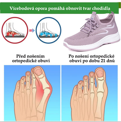 【⏰Poslední den, sleva 50 %! Nenechte si to ujít!】Ergonomicky tvarovaná ortopedická obuv s odpružením. ✅️Zdravá ortopedická obuv speciálně pro evropské ženy.